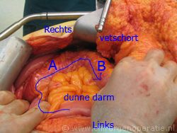 anatomie rechter helft dikke darm
