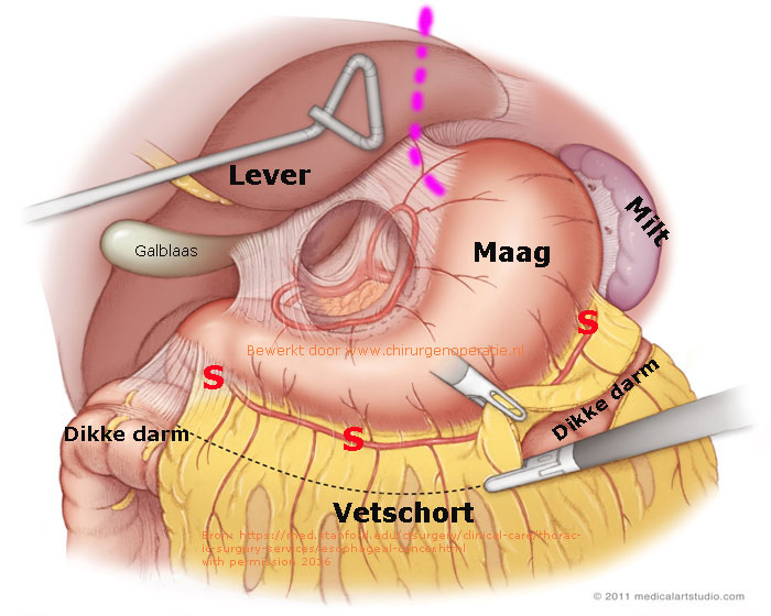 buismaag_laparoscopie_anatomie